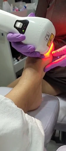 Sessão com laser durante atendimento podológico